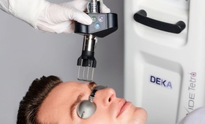 CoolPeel Laser