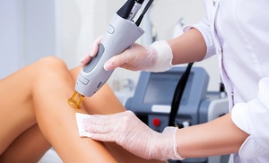 Hair-Free and Carefree: Get 6 Hair Removal Sessions for Flawless Skin