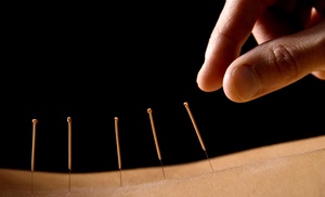 Up to 85% Off on Acupuncture Services at Trio Chiropractic and Wellness Center
