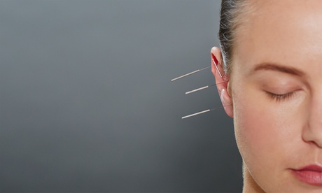 Relax and Relieve with Acupuncture Sessions