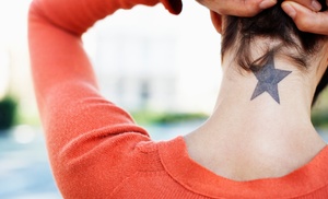 3 Tattoo-Removal Sessions on an Area up to 1, 3, 5, or 7 Square Inch 3 Tattoo-Removal Sessions on an Area up to 1, 3, 5, or 7 Square Inch