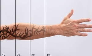 Laser Tattoo Removal Sessions on Small, Medium, or Large Areas at Advanced Health of Oakbrook – Up to 60% Off Laser Tattoo Removal Sessions on Small, Medium, or Large Areas at Advanced Health of Oakbrook – Up to 60% Off