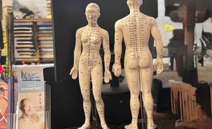 Choose from one, two, or three acupuncture sessions Choose from one, two, or three acupuncture sessions