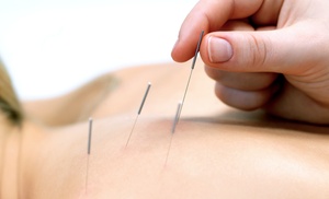 Experience Acupuncture Sessions to Relieve Pain Experience Acupuncture Sessions to Relieve Pain