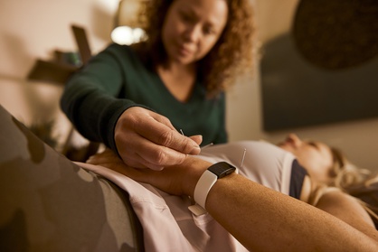 Acupuncture Sessions for Health and Wellness