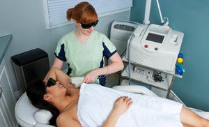 6 Laser Hair Removal for Various Areas: From Extra Small to XL