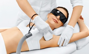 Laser Hair Removal Sessions on Any Area