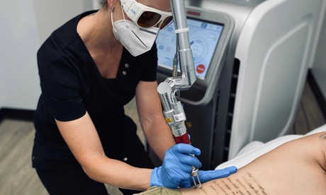 Unwanted Tattoo? Get 3 Tailored Sessions of Laser Tattoo Removal