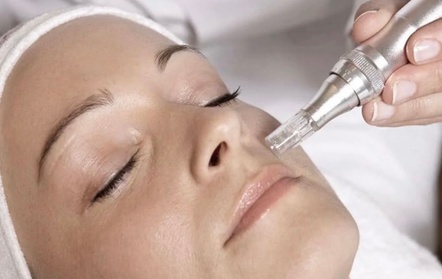 Experience The Blessings Medical Clinic's rejuvenating Microneedling