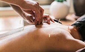 Up to 37% Off on Acupuncture at True Peace Acupuncture