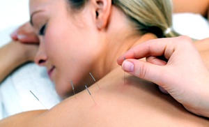 Up to 50% Off on Acupuncture at EB Natural Medicine Up to 50% Off on Acupuncture at EB Natural Medicine