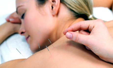 Up to 55% Off on Acupuncture at EB Natural Medicine Up to 55% Off on Acupuncture at EB Natural Medicine
