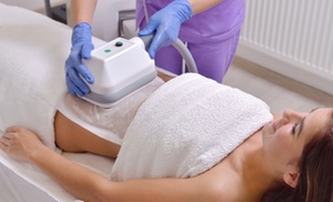 Up to 53% Off on CoolSculpting at NOVA MedSculpt Up to 53% Off on CoolSculpting at NOVA MedSculpt