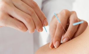 One Acupuncture session at Paul Acupuncture And Wellness