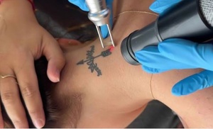 1 or 3 Laser Tattoo Removal Sessions on Small or Medium Area & More
