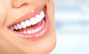 Up to 55% Off on Teeth Whitening - In-Office
