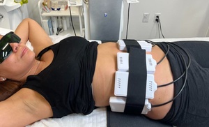 Lipo - Non-Invasive Laser-iLipo at Silhouette Aesthetic