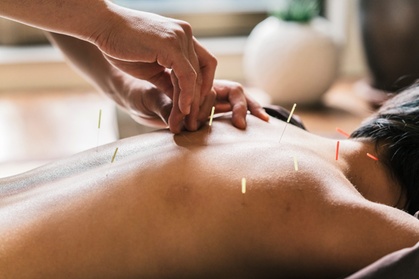 Up to 37% Off on Acupuncture at True Peace Acupuncture Up to 37% Off on Acupuncture at True Peace Acupuncture