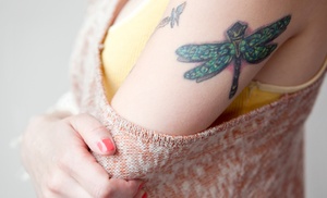 Tattoo removal session with laser technology for $100 Groupon Tattoo removal session with laser technology for $100 Groupon