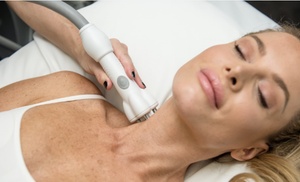 Non-surgical facelift sessions for rejuvenated skin tone Non-surgical facelift sessions for rejuvenated skin tone