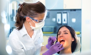 Limpieza bucodental completa