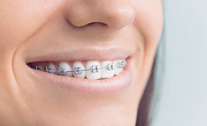 Ortodoncia con brackets a elegir en Clínica Futuredent