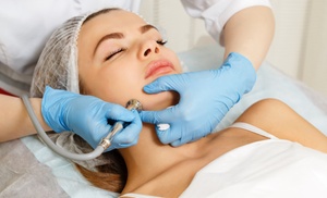 Limpieza Hydrafacial con opciones a elegir Diva Peluquería y Estética