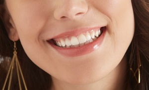 ¡Hola sonrisa deslumbrante! 1 o 2 sesiones de blanqueamiento dental