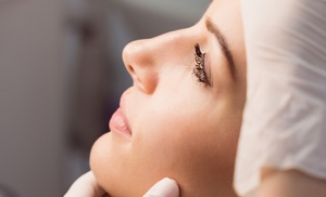 Infiltración facial efecto lifting con opción a retoque y mesoterapia