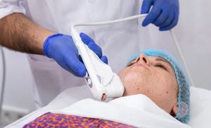 3 o 6 sesiones de tratamiento HIFU en The Look Madrid 3 o 6 sesiones de tratamiento HIFU en The Look Madrid