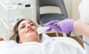 ¡Reduce de la grasa y la celulitis con Hifu Focal pro V10! ¡Reduce de la grasa y la celulitis con Hifu Focal pro V10!