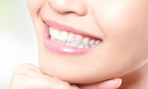 Sonrisas relucientes con empastes y limpieza bucal profesional Sonrisas relucientes con empastes y limpieza bucal profesional
