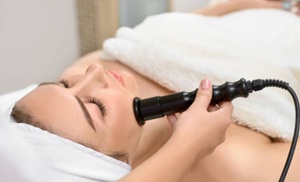 Reafirma la piel de tu rostro con sesiones de radiofrecuencia facial Reafirma la piel de tu rostro con sesiones de radiofrecuencia facial