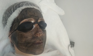 Peeling Hollywood con carbón activo, láser y vitaminas para el rostro