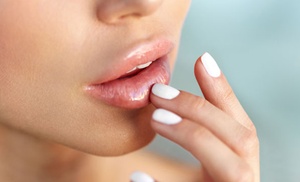 Infiltración de 1, 2 o 3 viales de relleno dérmico facial en 1 zona