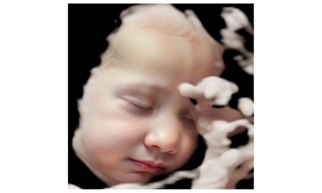 Visualiza a tu bebé: ecografía 8K o para descubrir el sexo del bebé Visualiza a tu bebé: ecografía 8K o para descubrir el sexo del bebé