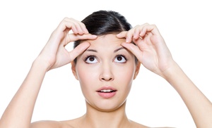 Tratamiento reafirmante inyectado en patas de gallo, entrecejo, frente Tratamiento reafirmante inyectado en patas de gallo, entrecejo, frente