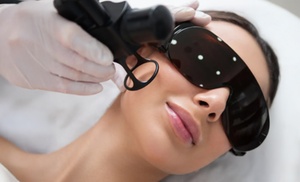 1 o 3 sesiones de rejuvenecimiento facial con láser revitalizante 1 o 3 sesiones de rejuvenecimiento facial con láser revitalizante