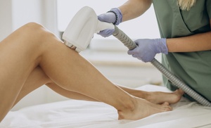 Hasta 7 sesiones de depilación láser SHR en zona a elegir