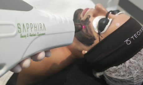 Tratamiento facial con láser en Sapphira Prive Madrid centro