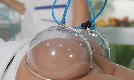 Levantamiento de glúteos en HIC Tratamientos de Belleza