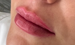 Relleno dérmico para labios: 1 o 2 viales para un resultado natural Relleno dérmico para labios: 1 o 2 viales para un resultado natural
