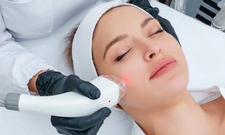 Tratamiento HIFU 12D Ultra-lifting con radiofrecuencia Tratamiento HIFU 12D Ultra-lifting con radiofrecuencia