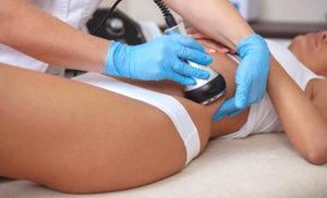 ¡Dile adiós a la celulitis con aparatología combinada! ¡Dile adiós a la celulitis con aparatología combinada!