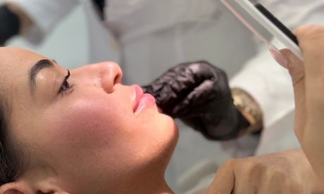 Vial infiltrado de relleno dérmico en zona a elegir Vial infiltrado de relleno dérmico en zona a elegir