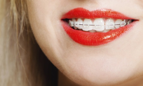 Ortodoncia con revisiones Ortodoncia con revisiones