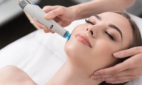 1 o 2 sesiones de microlifting facial de vitaminas con Dermapen para 1