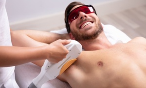 1, 3 o 6 sesiones de depilación con láser de diodo para hombre 1, 3 o 6 sesiones de depilación con láser de diodo para hombre