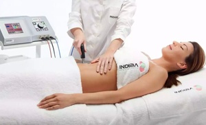 1, 2 o 4 sesiones de radiofrecuencia corporal Indiba en zona a elegir