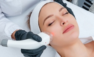 Tratamiento HIFU 12D Ultra-lifting con radiofrecuencia